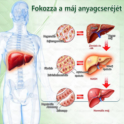 ✅Moringa · Berberine × NAD+ 10-in-1 Advanced Nano GeeLemon® Glumasetide 8az 1-ben Karcsú és EgészségesNano Mikrotűs Tapasz (Napi 1alkalom – látható változásakár 7 nap alatt) ✅ Elhízásra,bőrfeszesítésre,cukorbetegségre, alvásiapnoéra, ízületekre stb HU