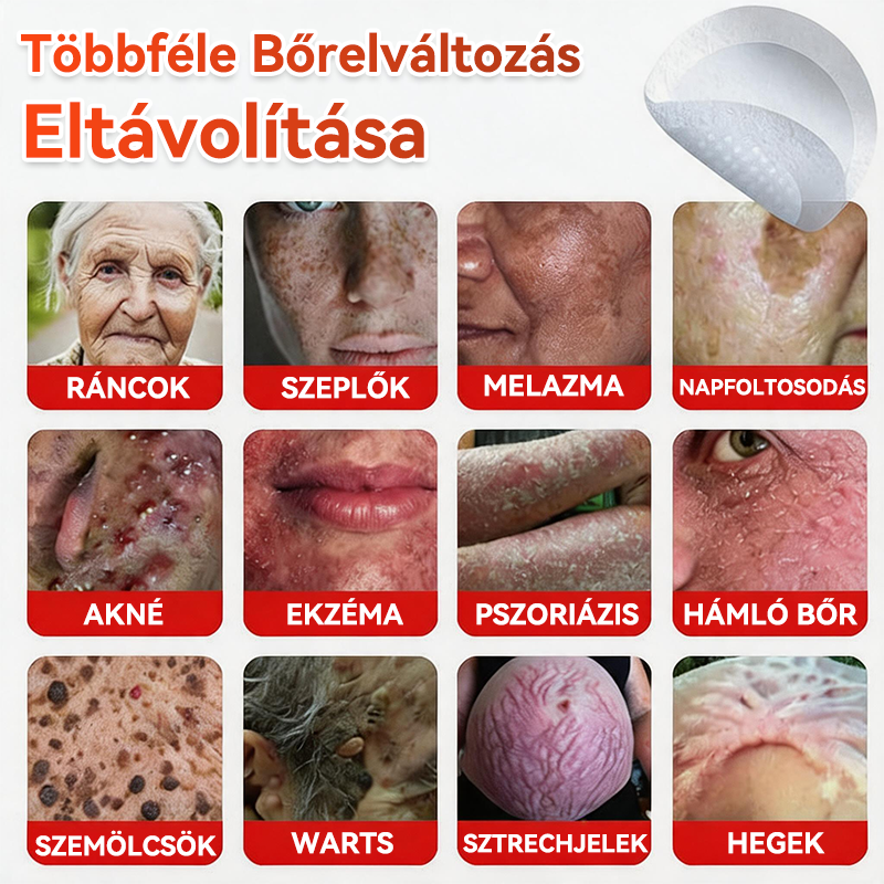 ✨GFOUK® Mikrotűs növényi bőrkinövés eltávolító tapasz