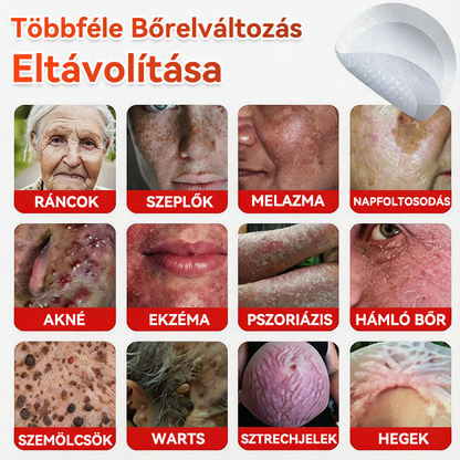 ✨GFOUK® Mikrotűs növényi bőrkinövés eltávolító tapasz