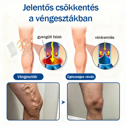 🏆🇭🇺👨‍⚕️✅TAILEDEN® VeinEase Mikrotűs Kezelő Tapasz⚡Azonnali Megkönnyebbülés, Hosszú Távú Eredmények