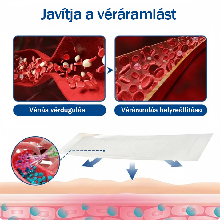 🏆🇭🇺👨‍⚕️✅TAILEDEN® VeinEase Mikrotűs Kezelő Tapasz⚡Azonnali Megkönnyebbülés, Hosszú Távú Eredmények