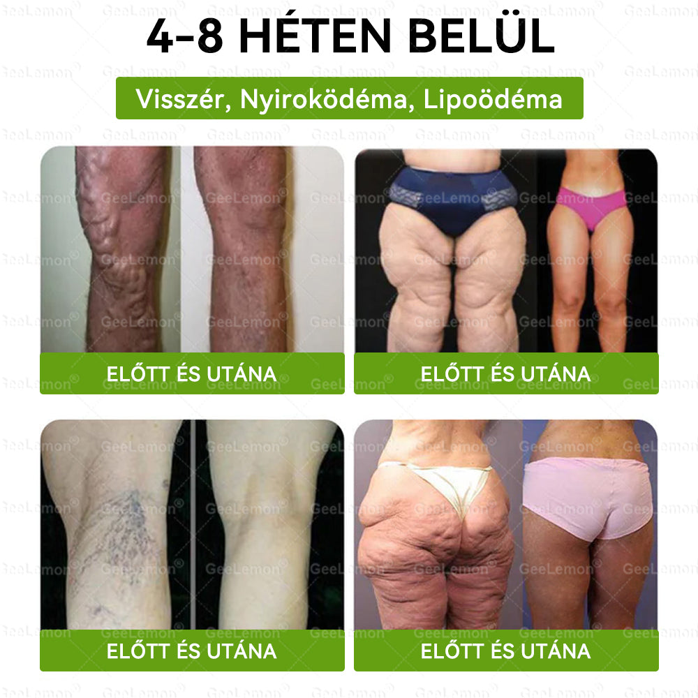 ✅Moringa · Berberine × NAD+ 10-in-1 Advanced Nano GeeLemon® Glumasetide 8az 1-ben Karcsú és EgészségesNano Mikrotűs Tapasz (Napi 1alkalom – látható változásakár 7 nap alatt) ✅ Elhízásra,bőrfeszesítésre,cukorbetegségre, alvásiapnoéra, ízületekre stb HU