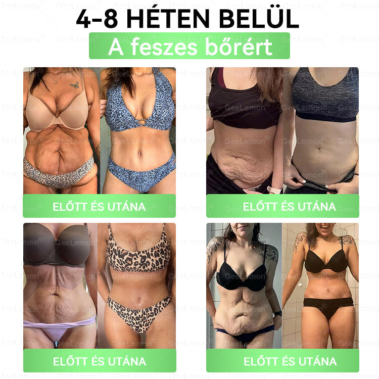 ✅Moringa · Berberine × NAD+ 10-in-1 Advanced Nano GeeLemon® Glumasetide 8az 1-ben Karcsú és EgészségesNano Mikrotűs Tapasz (Napi 1alkalom – látható változásakár 7 nap alatt) ✅ Elhízásra,bőrfeszesítésre,cukorbetegségre, alvásiapnoéra, ízületekre stb HU